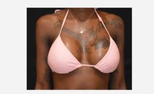 after front view breast augmentation female patient case 1966