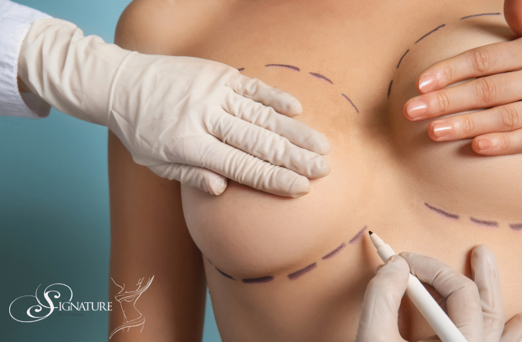 Breast Surgery