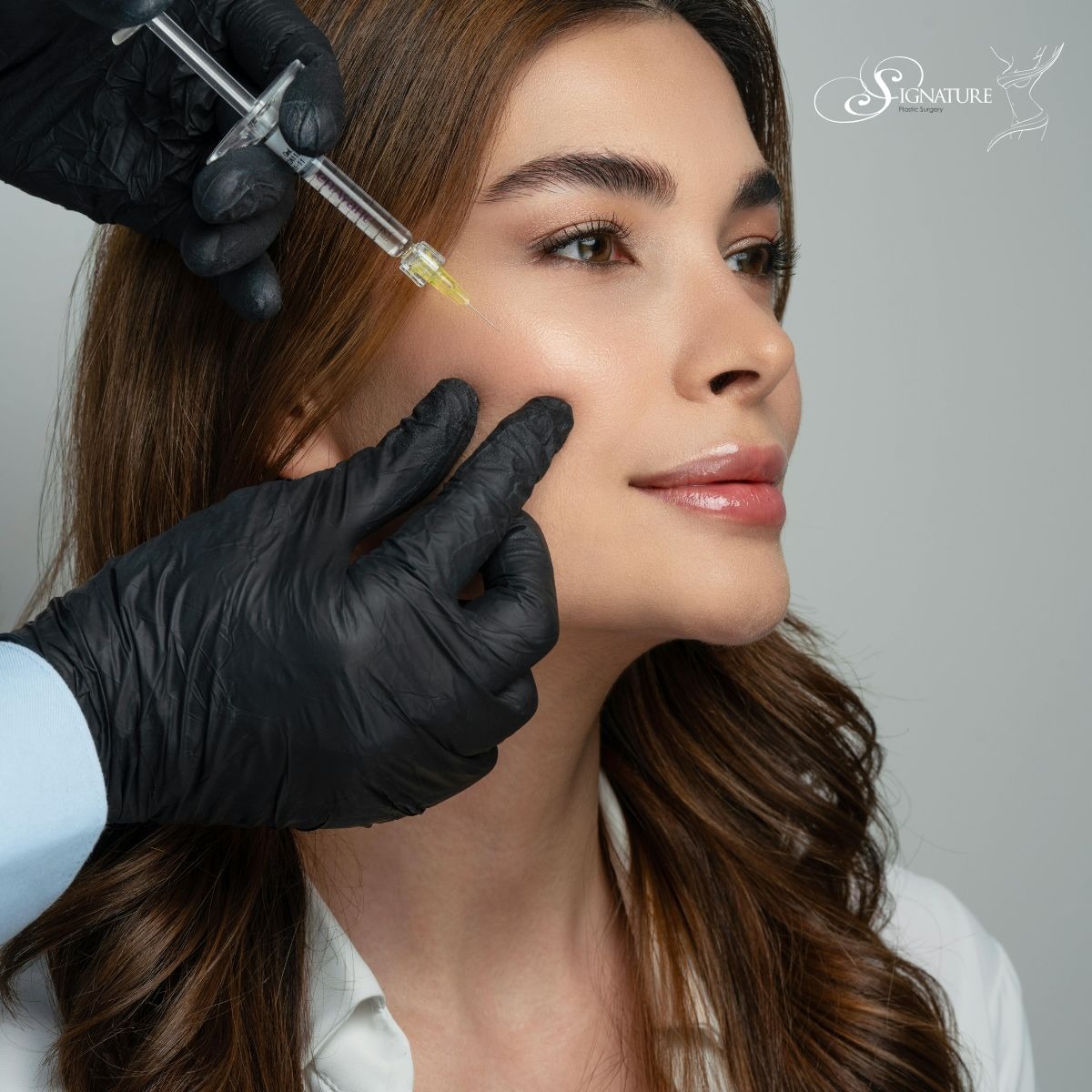 How Long Do Fillers and Botox Really Last?