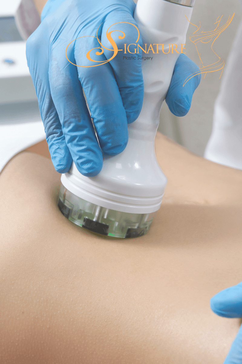 Body Contouring in Las Vegas: It’s Not Too Late to Get Results This Summer
