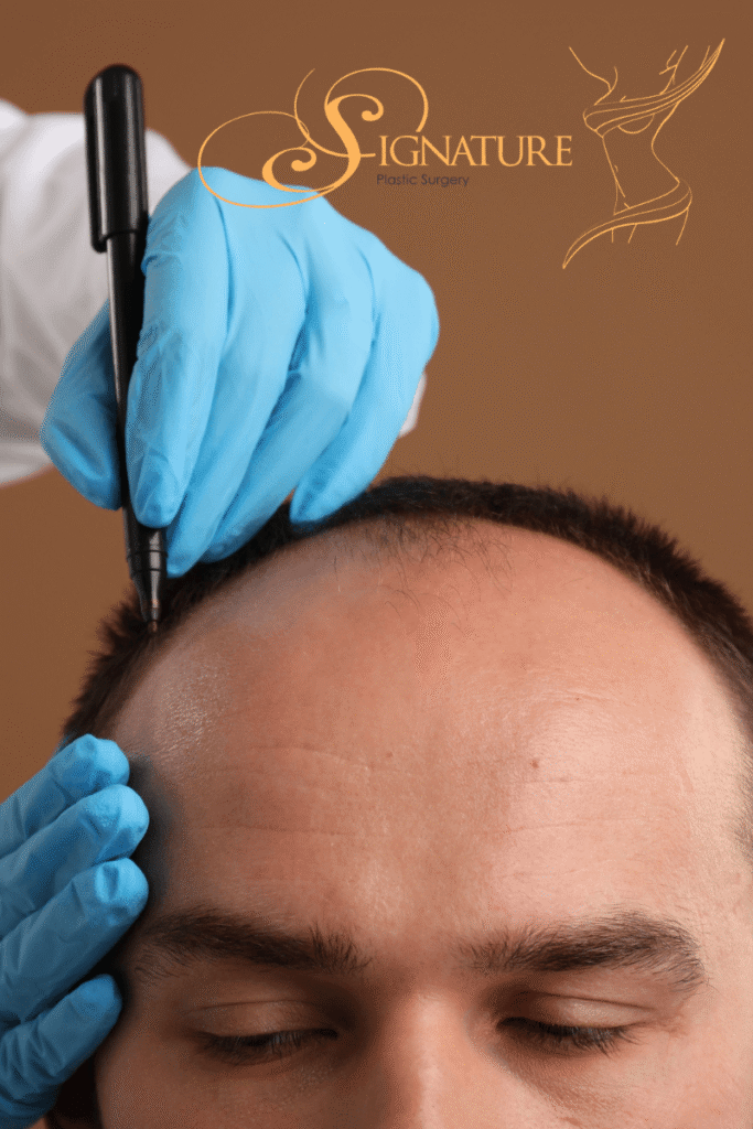 Hair Restoration in Las Vegas What NeoGraft Is and Whether It Is Right for You